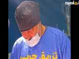 تزریق چربی به سینه