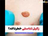 آیا زگیل تناسلی خطرناکه؟