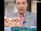 سفید کننده دندان .......
