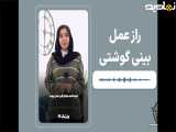 عمل بینی گوشتی - پزشک