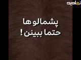 پشمالو ها ببینن..از بین بردن موهای زاید برای همیشه