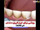 روشی برای جرم گیری دندان در خانه!