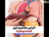 اگر این علائم و داری کبدت بیماره!