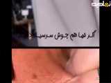اگر شما هم جوش سرسیاه دارید،حتما این ویدیو رو ببینید